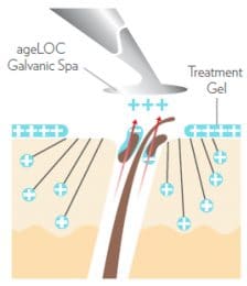 Infografik Positive Ladung des Galvanic Spa